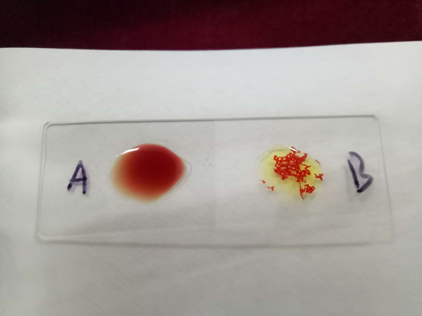 醫(yī)學(xué)檢驗(yàn)專業(yè)志愿者活動(dòng) 醫(yī)學(xué)檢驗(yàn)專業(yè)志愿者活動(dòng)